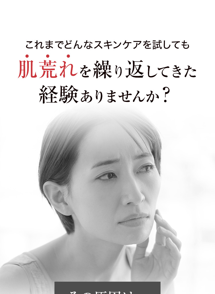 これまでどんなスキンケアを試しても肌荒れを繰り返してきた経験ありませんか？
